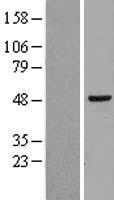 RAD23B / HR23B Protein - Western validation with an anti-DDK antibody * L: Control HEK293 lysate R: Over-expression lysate