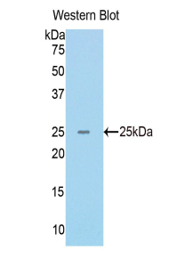 RAD50 Antibody - Western blot of recombinant RAD50.  This image was taken for the unconjugated form of this product. Other forms have not been tested.