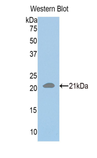RAD50 Antibody - Western blot of recombinant RAD50.  This image was taken for the unconjugated form of this product. Other forms have not been tested.