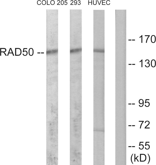 RAD50 Antibody - Western blot analysis of lysates from COLO205, 293, and HUVEC cells, using RAD50 Antibody. The lane on the right is blocked with the synthesized peptide.