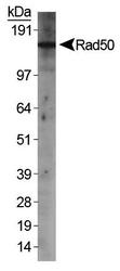 RAD50 Antibody - RAD50 Antibody - WB detection of Rad50 in HeLa nuclear extracts.