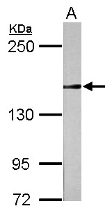 RAD50 Antibody - Sample (10 ug of whole cell lysate) A: Yeast 5% SDS PAGE RAD50 antibody diluted at 1:1000