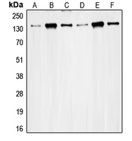 RAD50 Antibody - Western blot analysis of RAD50 expression in HeLa (A); K562 (B); Jurkat (C); MCF7 (D); Ramos (E); SW480 (F) whole cell lysates.