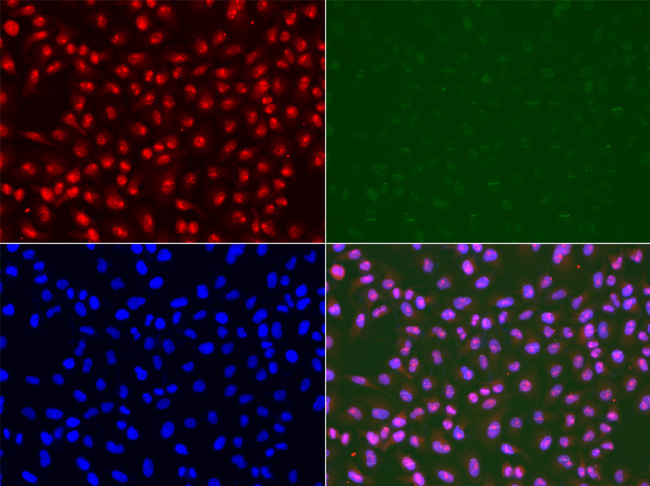 RAD50 Antibody - Immunofluorescence analysis of U2OS cells.