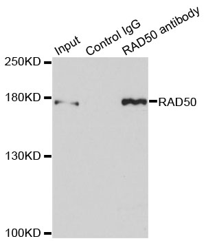 RAD50 Antibody - Immunoprecipitation analysis of 150ug extracts of MCF7 cells.