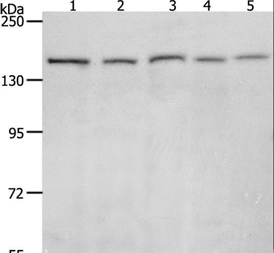 RAD50 Antibody - Western blot analysis of 293T, HeLa, K562, NIH/3T3 and RAW264.7 cell, using RAD50 Polyclonal Antibody at dilution of 1:900.