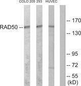 RAD50 Antibody - Western blot analysis of extracts from COLO205 cells, 293 cells and HUVEC cells, using RAD50 antibody.