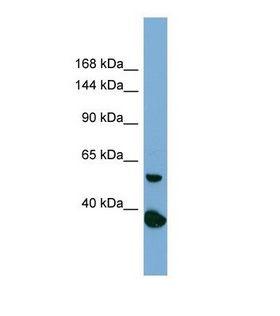 RAD50 Antibody - Western blot of Human PANC1. RAD50 antibody dilution 1.0 ug/ml.  This image was taken for the unconjugated form of this product. Other forms have not been tested.