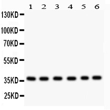 RAD51 / RECA Antibody - Rad51 antibody Western blot. All lanes: Anti Rad51 at 0.5 ug/ml. Lane 1: 22RV1 Whole Cell Lysate at 40 ug. Lane 2: SW620 Whole Cell Lysate at 40 ug. Lane 3: PANC Whole Cell Lysate at 40 ug. Lane 4: U87 Whole Cell Lysate at 40 ug. Lane 5: CEM Whole Cell Lysate at 40 ug. Lane 6: MM231 Whole Cell Lysate at 40 ug. Predicted band size: 37 kD. Observed band size: 37 kD.
