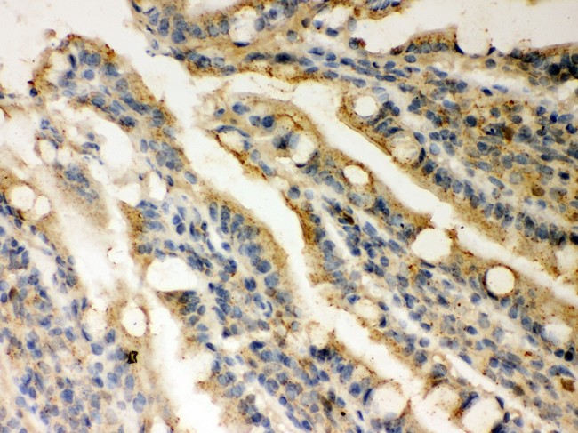 RAD51 / RECA Antibody - Rad51 antibody IHC-paraffin: Rat Intestine Tissue.