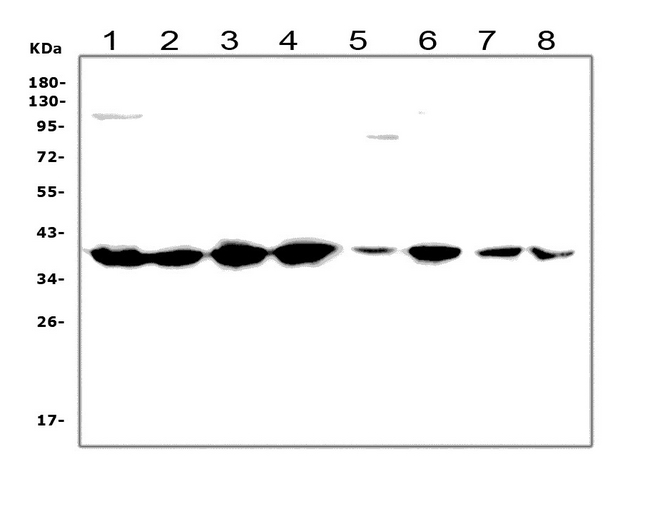 RAD51 / RECA Antibody - Western blot analysis of Rad51 using anti-Rad51 antibody. Electrophoresis was performed on a 5-20% SDS-PAGE gel at 70V (Stacking gel) / 90V (Resolving gel) for 2-3 hours. The sample well of each lane was loaded with 50ug of sample under reducing conditions. Lane 1: human Hela whole cell lysates, Lane 2: human HEK293 whole cell lysates, Lane 3: human Jurkat whole cell lysates, Lane 4: human K562 whole cell lysates, Lane 5: human THP-1 whole cell lysates, Lane 6: human Caco-2 whole cell lysates, Lane 7: human HepG2 whole cell lysates, Lane 8: human HL-60 whole cell lysates, After Electrophoresis, proteins were transferred to a Nitrocellulose membrane at 150mA for 50-90 minutes. Blocked the membrane with 5% Non-fat Milk/ TBS for 1.5 hour at RT. The membrane was incubated with rabbit anti-Rad51 antigen affinity purified polyclonal antibody at 0.5 µg/mL overnight at 4°C, then washed with TBS-0.1% Tween 3 times with 5 minutes each and probed with a goat anti-rabbit IgG-HRP secondary antibody at a dilution of 1:10000 for 1.5 hour at RT. The signal is developed using an Enhanced Chemiluminescent detection (ECL) kit with Tanon 5200 system. A specific band was detected for Rad51 at approximately 39KD. The expected band size for Rad51 is at 37KD.