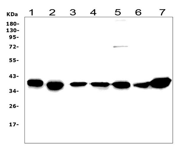 RAD51 / RECA Antibody - Western blot analysis of Rad51 using anti-Rad51 antibody. Electrophoresis was performed on a 5-20% SDS-PAGE gel at 70V (Stacking gel) / 90V (Resolving gel) for 2-3 hours. The sample well of each lane was loaded with 50ug of sample under reducing conditions. Lane 1: rat testicular tissue lysates, Lane 2: rat thymus tissue lysates, Lane 3: rat C6 whole cell lysates, Lane 4: mouse testicular tissue lysates, Lane 5: mouse thymus tissue lysates, Lane 6: mouse NIH/3T3 whole cell lysates, Lane 7: mouse RAW246. 7 whole cell lysates, After Electrophoresis, proteins were transferred to a Nitrocellulose membrane at 150mA for 50-90 minutes. Blocked the membrane with 5% Non-fat Milk/ TBS for 1.5 hour at RT. The membrane was incubated with rabbit anti-Rad51 antigen affinity purified polyclonal antibody at 0.5 µg/mL overnight at 4°C, then washed with TBS-0.1% Tween 3 times with 5 minutes each and probed with a goat anti-rabbit IgG-HRP secondary antibody at a dilution of 1:10000 for 1.5 hour at RT. The signal is developed using an Enhanced Chemiluminescent detection (ECL) kit with Tanon 5200 system. A specific band was detected for Rad51 at approximately 39KD. The expected band size for Rad51 is at 37KD.