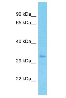 RAD51 / RECA Antibody - RAD51 / RECA antibody Western Blot of HCT15. Antibody dilution: 1 ug/ml.  This image was taken for the unconjugated form of this product. Other forms have not been tested.