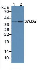 RAD51 / RECA Antibody - Western Blot; Sample: Lane1: Human Hela Cells; Lane2: Human Jurkat Cells.