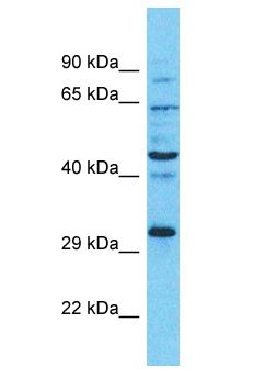 RAD51 / RECA Antibody - RAD51 / RECA antibody Western Blot of HCT15. Antibody dilution: 1 ug/ml.  This image was taken for the unconjugated form of this product. Other forms have not been tested.