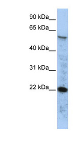 RAD51 / RECA Antibody - RAD51 antibody Western blot of HepG2 cell lysate. This image was taken for the unconjugated form of this product. Other forms have not been tested.