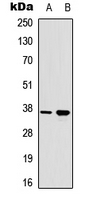 RAD51 / RECA Antibody - Western blot analysis of RAD51A (pY315) expression in HeLa UV-treated (A); HEK293T UV-treated (B) whole cell lysates.