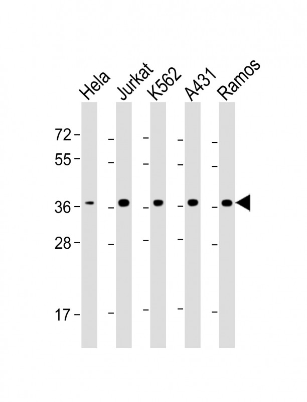 RAD51 / RECA Antibody - All lanes: Anti-RAD51 Antibody at 1:4000 dilution Lane 1: Hela whole cell lysate Lane 2: Jurkat whole cell lysate Lane 3: K562 whole cell lysate Lane 4: A431 whole cell lysate Lane 5: Ramos whole cell lysate Lysates/proteins at 20 µg per lane. Secondary Goat Anti-mouse IgG, (H+L), Peroxidase conjugated at 1/10000 dilution. Predicted band size: 37 kDa Blocking/Dilution buffer: 5% NFDM/TBST.