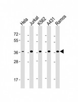 RAD51 / RECA Antibody - All lanes: Anti-RAD51 Antibody at 1:4000 dilution Lane 1: Hela whole cell lysate Lane 2: Jurkat whole cell lysate Lane 3: K562 whole cell lysate Lane 4: A431 whole cell lysate Lane 5: Ramos whole cell lysate Lysates/proteins at 20 µg per lane. Secondary Goat Anti-mouse IgG, (H+L), Peroxidase conjugated at 1/10000 dilution. Predicted band size: 37 kDa Blocking/Dilution buffer: 5% NFDM/TBST.