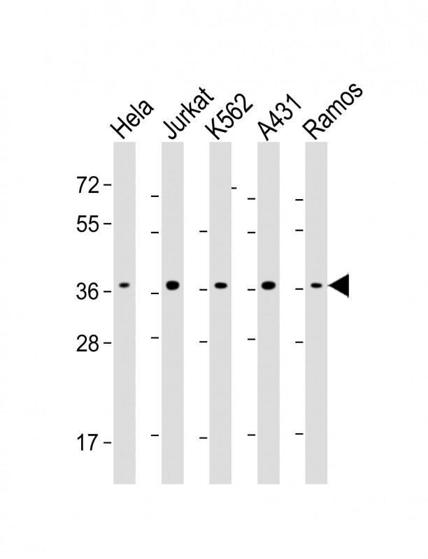 RAD51 / RECA Antibody - All lanes: Anti-RAD51 Antibody at 1:2000-1:4000 dilution Lane 1: Hela whole cell lysate Lane 2: Jurkat whole cell lysate Lane 3: K562 whole cell lysate Lane 4: A431 whole cell lysate Lane 5: Ramos whole cell lysate Lysates/proteins at 20 µg per lane. Secondary Goat Anti-mouse IgG, (H+L), Peroxidase conjugated at 1/10000 dilution. Predicted band size: 37 kDa Blocking/Dilution buffer: 5% NFDM/TBST.