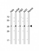 RAD51 / RECA Antibody - All lanes: Anti-RAD51 Antibody at 1:2000-1:4000 dilution Lane 1: Hela whole cell lysate Lane 2: Jurkat whole cell lysate Lane 3: K562 whole cell lysate Lane 4: A431 whole cell lysate Lane 5: Ramos whole cell lysate Lysates/proteins at 20 µg per lane. Secondary Goat Anti-mouse IgG, (H+L), Peroxidase conjugated at 1/10000 dilution. Predicted band size: 37 kDa Blocking/Dilution buffer: 5% NFDM/TBST.