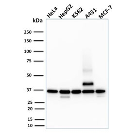 RAD51 / RECA Antibody - Western blot testing of human HeLa, HepG2, K562, A431 and MCF-7 cell lysate with RAD51 antibody. Expected molecular weight ~37 kDa.