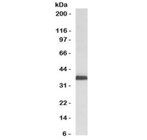 RAD51 / RECA Antibody - Western blot testing of human HeLa cell lysate with RAD51 antibody (clone RALPA-1). Expected molecular weight ~37 kDa.