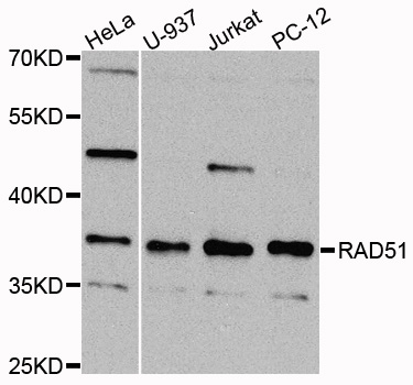 RAD51 / RECA Antibody - Western blot analysis of extracts of various cells.