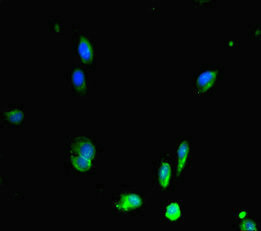 RAD51 / RECA Antibody - Immunofluorescent analysis of Hela cells diluted at 1:100 and Alexa Fluor 488-congugated AffiniPure Goat Anti-Rabbit IgG(H+L)