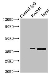 RAD51 / RECA Antibody - Immunoprecipitating RAD51 in K562 whole cell lysate Lane 1: Rabbit monoclonal IgG (1µg) instead of product in K562 whole cell lysate.For western blotting,a HRP-conjugated Protein G antibody was used as the Secondary antibody (1/50000) Lane 2: product (4µg) + K562 whole cell lysate (500µg) Lane 3: K562 whole cell lysate (20µg)