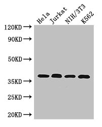 RAD51 / RECA Antibody - Western Blot Positive WB detected in:Hela whole cell lysate,Jurkat whole cell lysate,NIH/3T3 whole cell lysate,K562 whole cell lysate All Lanes: RAD51 antibody at 2.7ug/ml Secondary Goat polyclonal to rabbit IgG at 1/50000 dilution Predicted band size: 37,27,32 kDa Observed band size: 37 kDa