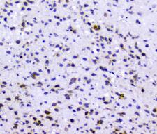 RAD51 / RECA Antibody - IHC analysis of Rad51 using anti-Rad51 antibody. Rad51 was detected in paraffin-embedded section of rat brain tissues. Heat mediated antigen retrieval was performed in citrate buffer (pH6, epitope retrieval solution) for 20 mins. The tissue section was blocked with 10% goat serum. The tissue section was then incubated with 1µg/ml rabbit anti-Rad51 Antibody overnight at 4°C. Biotinylated goat anti-rabbit IgG was used as secondary antibody and incubated for 30 minutes at 37°C. The tissue section was developed using Strepavidin-Biotin-Complex (SABC) with DAB as the chromogen.