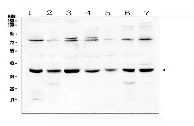 RAD51 / RECA Antibody - Western blot analysis of Rad51 using anti-Rad51 antibody. Electrophoresis was performed on a 5-20% SDS-PAGE gel at 70V (Stacking gel) / 90V (Resolving gel) for 2-3 hours. The sample well of each lane was loaded with 50ug of sample under reducing conditions. Lane 1: human Hela whole cell lysate,Lane 2: human A431 whole cell lysate,Lane 3: human 293T whole cell lysate,Lane 4: human K562 whole cell lysate,Lane 5: human Jurkat whole cell lysate,Lane 6: human A549 whole cell lysate,Lane 7: human Caco-2 whole cell lysate. After Electrophoresis, proteins were transferred to a Nitrocellulose membrane at 150mA for 50-90 minutes. Blocked the membrane with 5% Non-fat Milk/ TBS for 1.5 hour at RT. The membrane was incubated with rabbit anti-Rad51 antigen affinity purified polyclonal antibody at 0.5 µg/mL overnight at 4°C, then washed with TBS-0.1% Tween 3 times with 5 minutes each and probed with a goat anti-rabbit IgG-HRP secondary antibody at a dilution of 1:10000 for 1.5 hour at RT. The signal is developed using an Enhanced Chemiluminescent detection (ECL) kit with Tanon 5200 system. A specific band was detected for Rad51 at approximately 39KD. The expected band size for Rad51 is at 36KD.