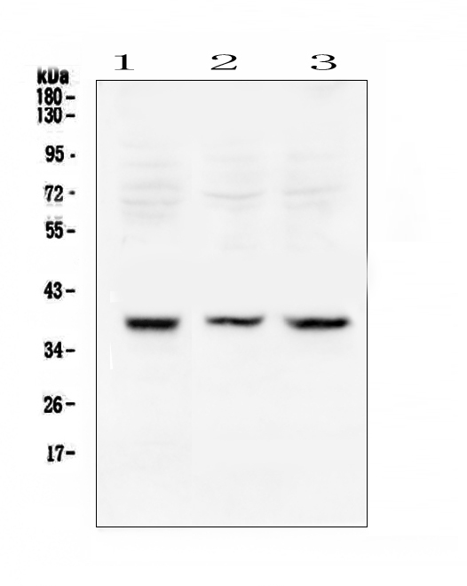RAD51 / RECA Antibody - Western blot analysis of Rad51 using anti-Rad51 antibody. Electrophoresis was performed on a 5-20% SDS-PAGE gel at 70V (Stacking gel) / 90V (Resolving gel) for 2-3 hours. The sample well of each lane was loaded with 50ug of sample under reducing conditions. Lane 1: rat testis tissue lysates,Lane 2: mouse testis tissue lysates,Lane 3: mouse thymus tissue lysates. After Electrophoresis, proteins were transferred to a Nitrocellulose membrane at 150mA for 50-90 minutes. Blocked the membrane with 5% Non-fat Milk/ TBS for 1.5 hour at RT. The membrane was incubated with rabbit anti-Rad51 antigen affinity purified polyclonal antibody at 0.5 µg/mL overnight at 4°C, then washed with TBS-0.1% Tween 3 times with 5 minutes each and probed with a goat anti-rabbit IgG-HRP secondary antibody at a dilution of 1:10000 for 1.5 hour at RT. The signal is developed using an Enhanced Chemiluminescent detection (ECL) kit with Tanon 5200 system. A specific band was detected for Rad51 at approximately 39KD. The expected band size for Rad51 is at 36KD.