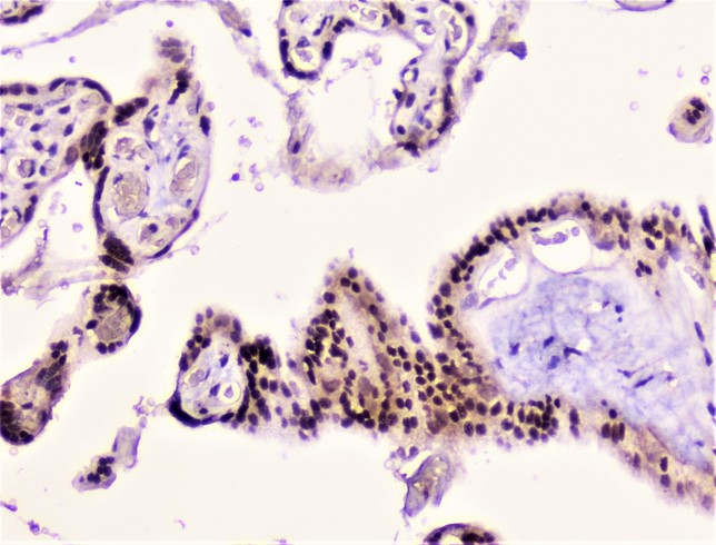 RAD51 / RECA Antibody - IHC analysis of Rad51 using anti-Rad51 antibody. Rad51 was detected in paraffin-embedded section of human placenta tissue. Heat mediated antigen retrieval was performed in citrate buffer (pH6, epitope retrieval solution) for 20 mins. The tissue section was blocked with 10% goat serum. The tissue section was then incubated with 1µg/ml rabbit anti-Rad51 Antibody overnight at 4°C. Biotinylated goat anti-rabbit IgG was used as secondary antibody and incubated for 30 minutes at 37°C. The tissue section was developed using Strepavidin-Biotin-Complex (SABC) with DAB as the chromogen.