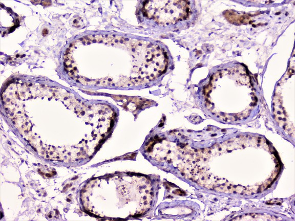 RAD51 / RECA Antibody - IHC analysis of Rad51 using anti-Rad51 antibody. Rad51 was detected in paraffin-embedded section of human testis tissue. Heat mediated antigen retrieval was performed in citrate buffer (pH6, epitope retrieval solution) for 20 mins. The tissue section was blocked with 10% goat serum. The tissue section was then incubated with 1µg/ml rabbit anti-Rad51 Antibody overnight at 4°C. Biotinylated goat anti-rabbit IgG was used as secondary antibody and incubated for 30 minutes at 37°C. The tissue section was developed using Strepavidin-Biotin-Complex (SABC) with DAB as the chromogen.