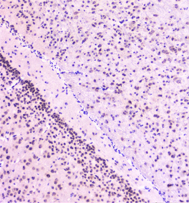 RAD51 / RECA Antibody - IHC analysis of Rad51 using anti-Rad51 antibody. Rad51 was detected in paraffin-embedded section of mouse brain tissue. Heat mediated antigen retrieval was performed in citrate buffer (pH6, epitope retrieval solution) for 20 mins. The tissue section was blocked with 10% goat serum. The tissue section was then incubated with 1µg/ml rabbit anti-Rad51 Antibody overnight at 4°C. Biotinylated goat anti-rabbit IgG was used as secondary antibody and incubated for 30 minutes at 37°C. The tissue section was developed using Strepavidin-Biotin-Complex (SABC) with DAB as the chromogen.