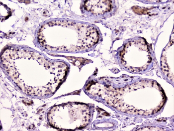 RAD51 / RECA Antibody - IHC staining of FFPE human testis with RAD51 antibody at 1ug/ml. HIER: boil tissue sections in pH6, 10mM citrate buffer, for 10-20 min followed by cooling at RT for 20 min.