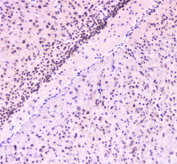 RAD51 / RECA Antibody - IHC staining of FFPE mouse brain with RAD51 antibody at 1ug/ml. HIER: boil tissue sections in pH6, 10mM citrate buffer, for 10-20 min followed by cooling at RT for 20 min.
