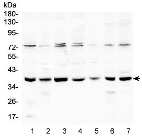 RAD51 / RECA Antibody - Western blot testing of human 1) HeLa, 2) A431, 3) 293T, 4) K562, 5) Jurkat, 6) A549 and 7) Caco-2 lysate with RAD51 antibody at 0.5ug/ml. Predicted molecular weight ~37 kDa.