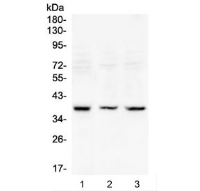 RAD51 / RECA Antibody - Western blot testing of 1) rat testis, 2) mouse testis and 3) mouse thymus lysate with RAD51 antibody at 0.5ug/ml. Predicted molecular weight ~37 kDa.