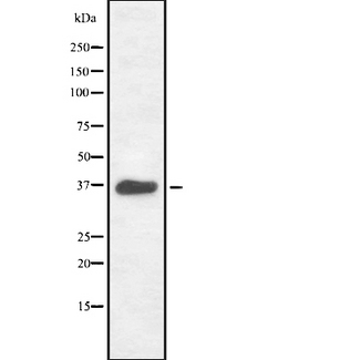 RAD51 / RECA Antibody - Western blot analysis of RAD51 using COLO205 whole cells lysates