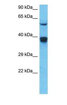 RAD51 / RECA Antibody - Western blot of RAD51 Antibody with human HepG2 Whole Cell lysate.  This image was taken for the unconjugated form of this product. Other forms have not been tested.