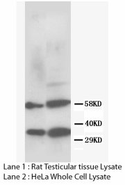 RAD51 / RECA Antibody -  This image was taken for the unconjugated form of this product. Other forms have not been tested.