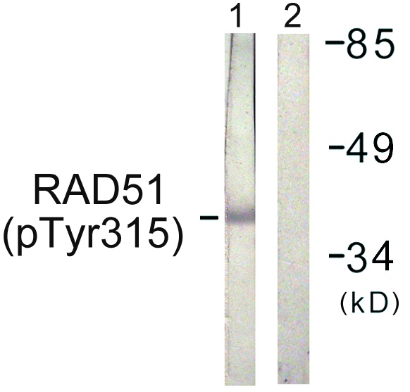 RAD51 / RECA Antibody - Western blot analysis of lysates from Jurkat cells, using RAD51 (Phospho-Tyr315) Antibody. The lane on the right is blocked with the phospho peptide.