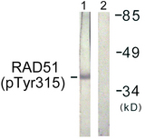 RAD51 / RECA Antibody - Western blot analysis of lysates from Jurkat cells, using RAD51 (Phospho-Tyr315) Antibody. The lane on the right is blocked with the phospho peptide.