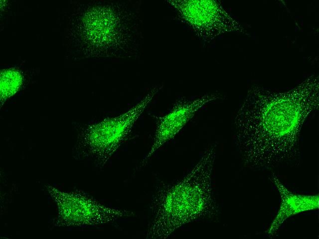 RAD51 / RECA Antibody - Immunofluorescence staining of RAD51 in HeLa cells. Cells were fixed with 4% PFA, permeabilzed with 0.3% Triton X-100 in PBS, blocked with 10% serum, and incubated with rabbit anti-human RAD51 polyclonal antibody (dilution ratio: 1:1000) at 4°C overnight. Then cells were stained with the Alexa Fluor 488-conjugated Goat Anti-rabbit IgG secondary antibody (green). Positive staining was localized to cytoplasm and nucleus.