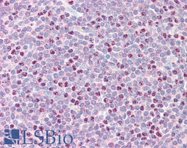 RAD51B Antibody - Anti-RAD51B antibody IHC staining of human tonsil. Immunohistochemistry of formalin-fixed, paraffin-embedded tissue after heat-induced antigen retrieval. Antibody concentration 10 ug/ml.  This image was taken for the unconjugated form of this product. Other forms have not been tested.