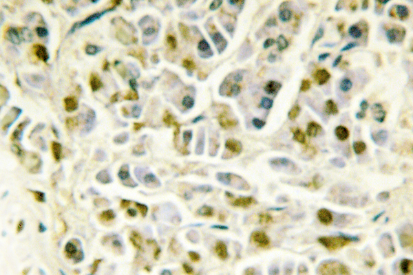 RAD51B Antibody - IHC of Rad51B (G226) pAb in paraffin-embedded human pancreas tissue.