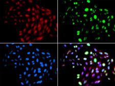 RAD51B Antibody - Immunofluorescence analysis of GFP-RNF168 trangenic U2OS cells.